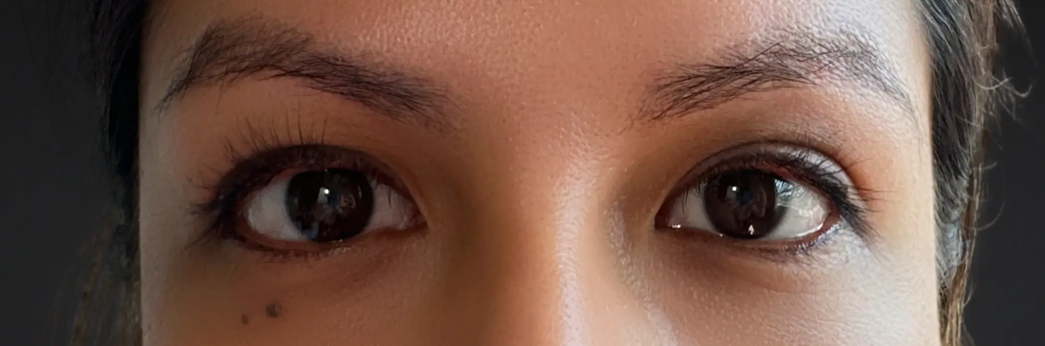 Example: both eyes, before the close-up